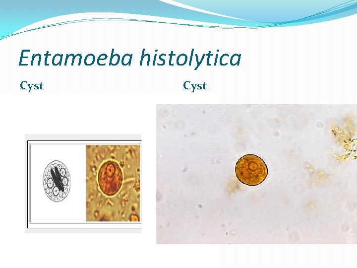Entamoeba histolytica Cyst 