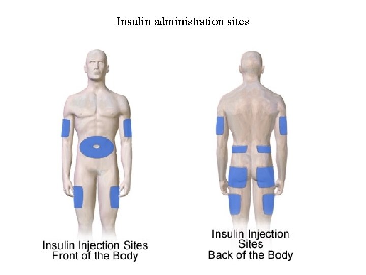 Insulin administration sites 