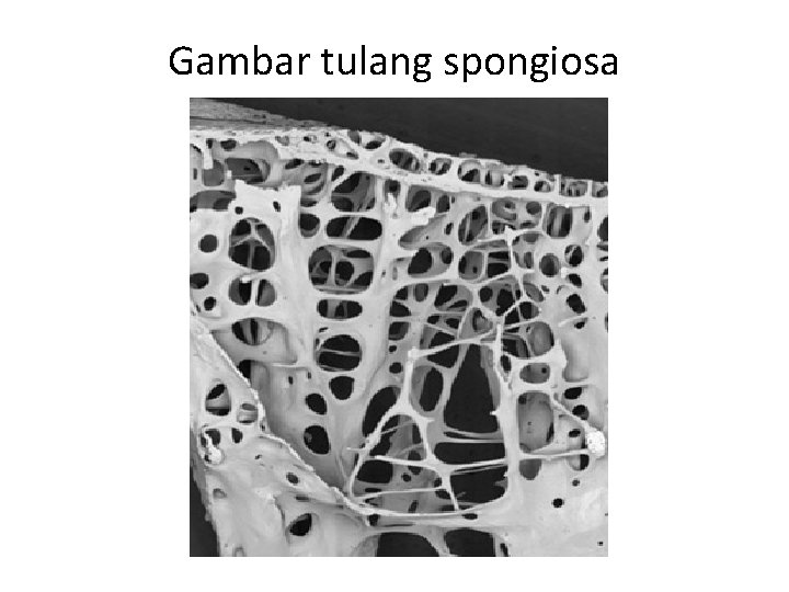 Gambar tulang spongiosa 