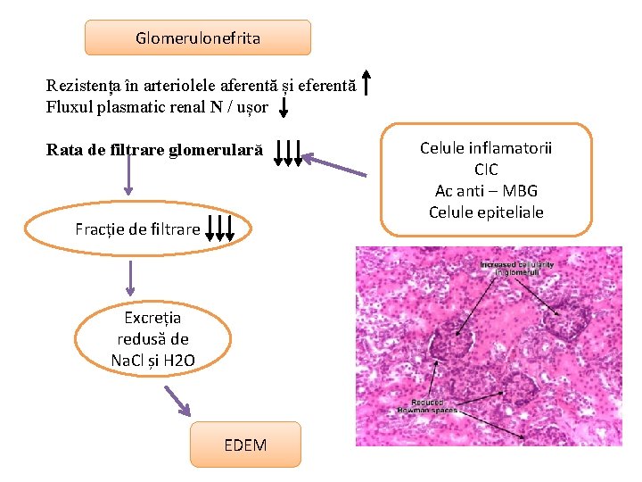 Glomerulonefrita Rezistența în arteriolele aferentă și eferentă Fluxul plasmatic renal N / ușor Rata