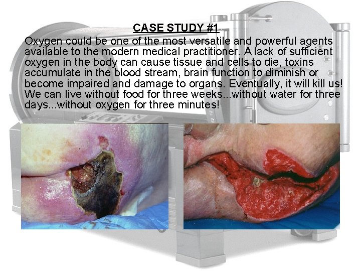 CASE STUDY #1 Oxygen could be one of the most versatile and powerful agents