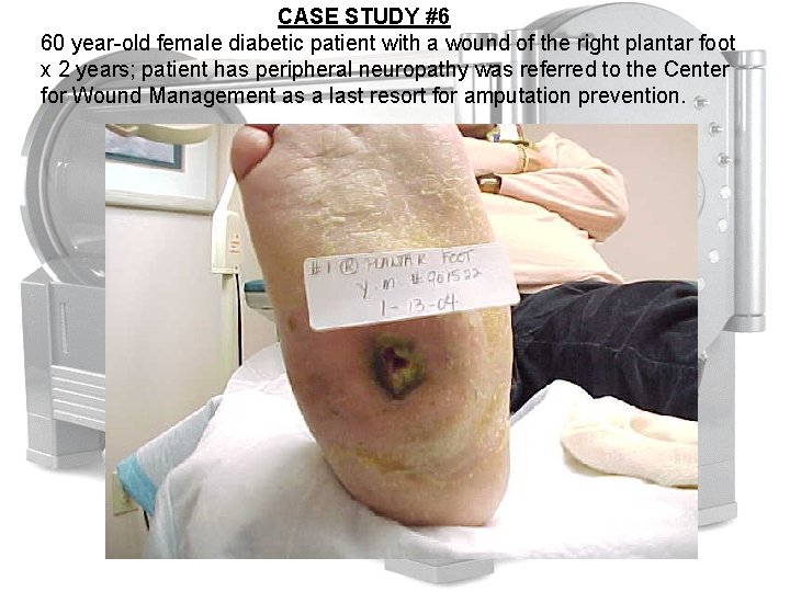CASE STUDY #6 60 year-old female diabetic patient with a wound of the right