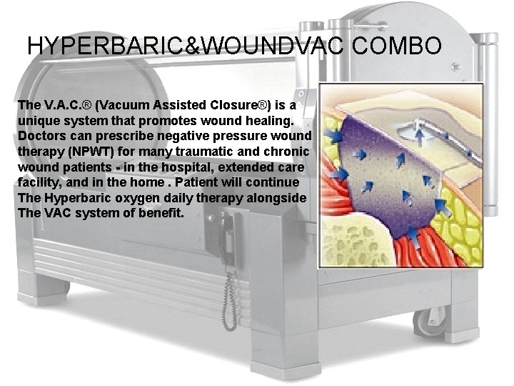 HYPERBARIC&WOUNDVAC COMBO The V. A. C. ® (Vacuum Assisted Closure®) is a unique system