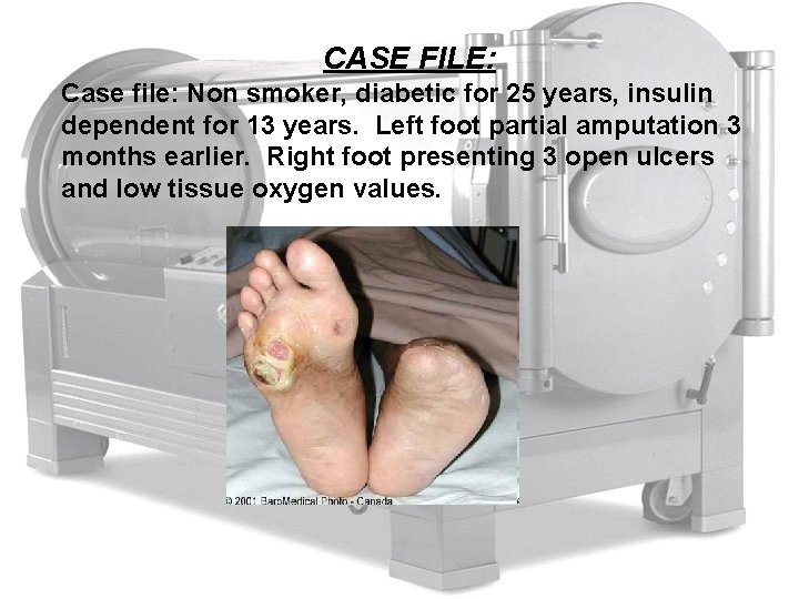 CASE FILE: Case file: Non smoker, diabetic for 25 years, insulin dependent for 13