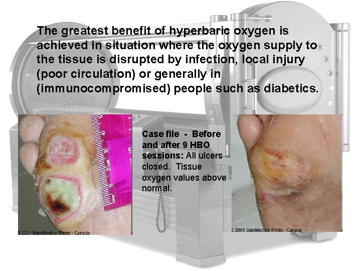 The greatest benefit of hyperbaric oxygen is achieved in situation where the oxygen supply