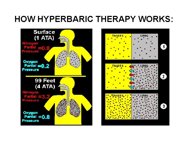 HOW HYPERBARIC THERAPY WORKS: 