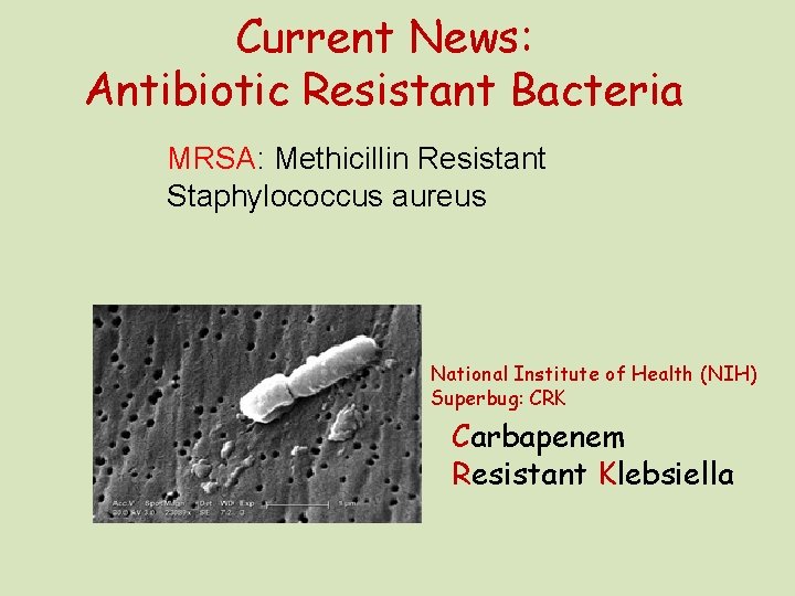 Current News: Antibiotic Resistant Bacteria MRSA: Methicillin Resistant Staphylococcus aureus National Institute of Health