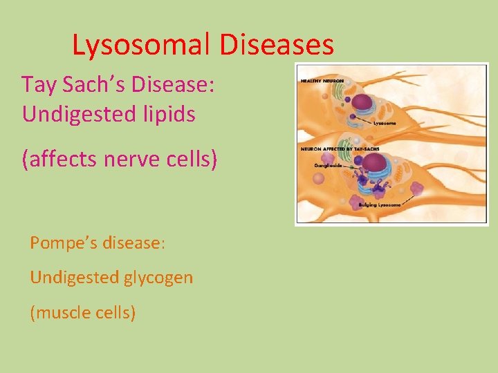 Lysosomal Diseases Tay Sach’s Disease: Undigested lipids (affects nerve cells) Pompe’s disease: Undigested glycogen