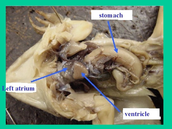 stomach Left atrium ventricle 