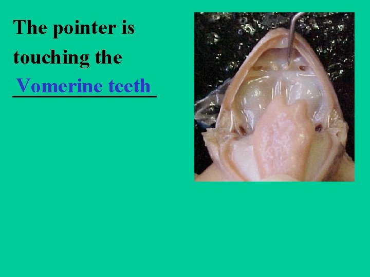 The pointer is touching the Vomerine teeth _______ 