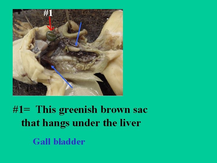#1 #1= This greenish brown sac that hangs under the liver Gall bladder 