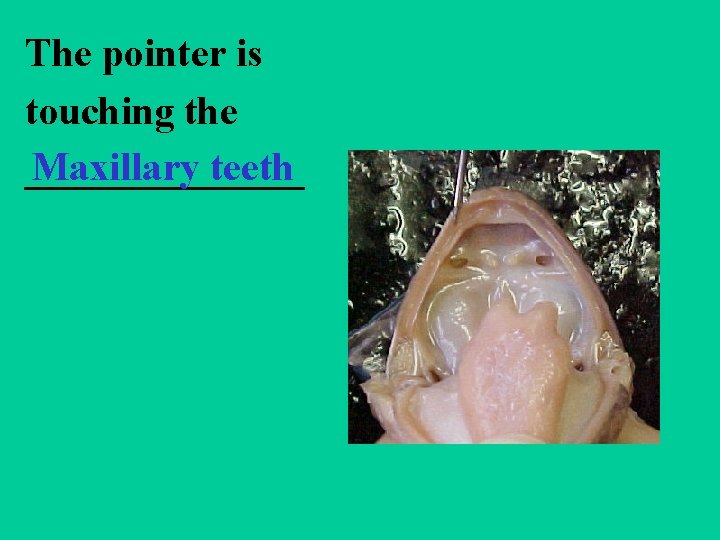 The pointer is touching the Maxillary teeth _______ 