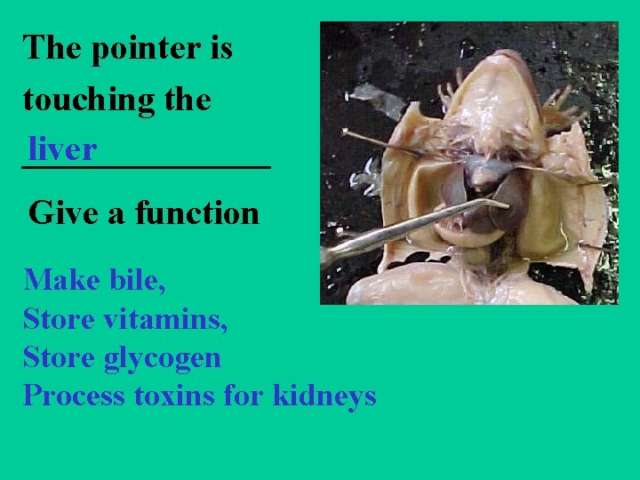 The pointer is touching the liver _______ Give a function Make bile, Store vitamins,