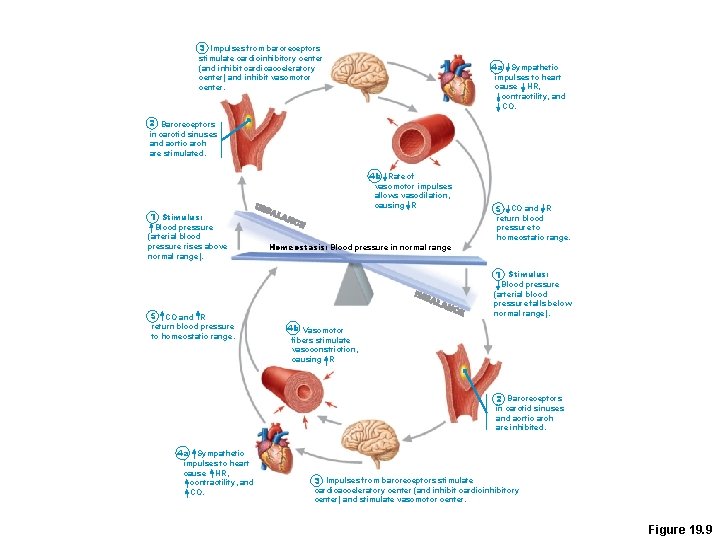 3 Impulses from baroreceptors stimulate cardioinhibitory center (and inhibit cardioacceleratory center) and inhibit vasomotor