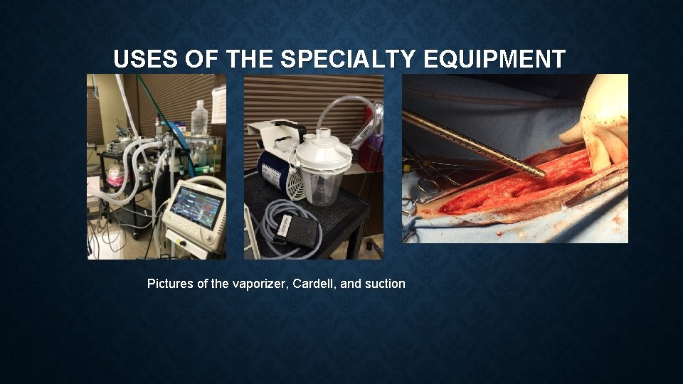 USES OF THE SPECIALTY EQUIPMENT Pictures of the vaporizer, Cardell, and suction 