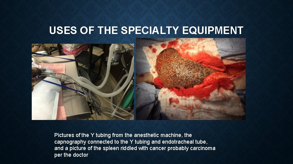 USES OF THE SPECIALTY EQUIPMENT Pictures of the Y tubing from the anesthetic machine,