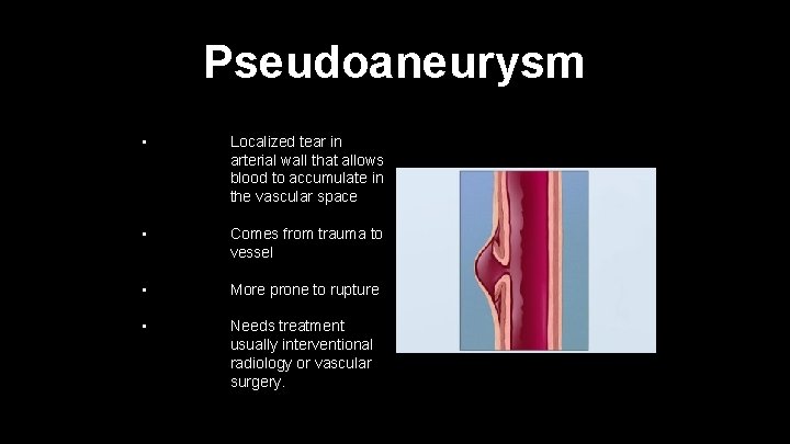 Pseudoaneurysm • Localized tear in arterial wall that allows blood to accumulate in the