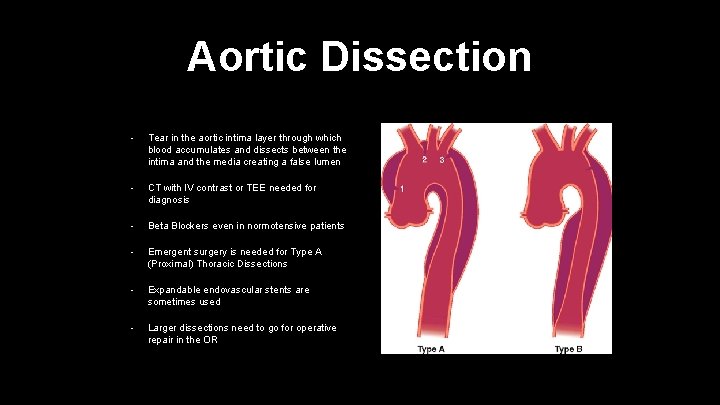 Aortic Dissection • Tear in the aortic intima layer through which blood accumulates and