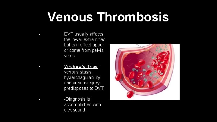 Venous Thrombosis • DVT usually affects the lower extremities but can affect upper or
