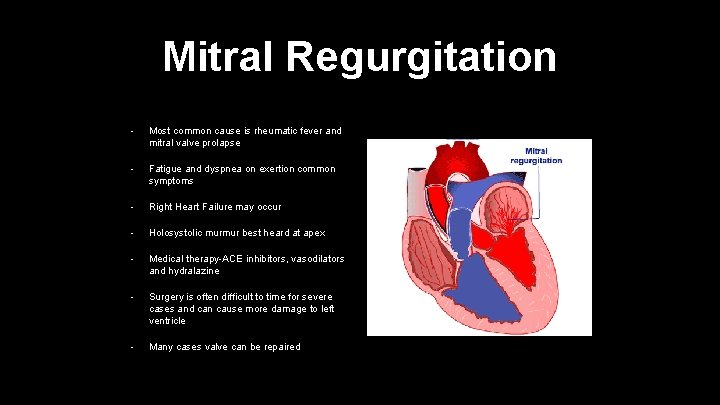 Mitral Regurgitation • Most common cause is rheumatic fever and mitral valve prolapse •