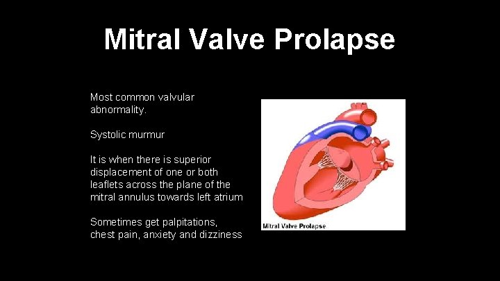 Mitral Valve Prolapse Most common valvular abnormality. Systolic murmur It is when there is