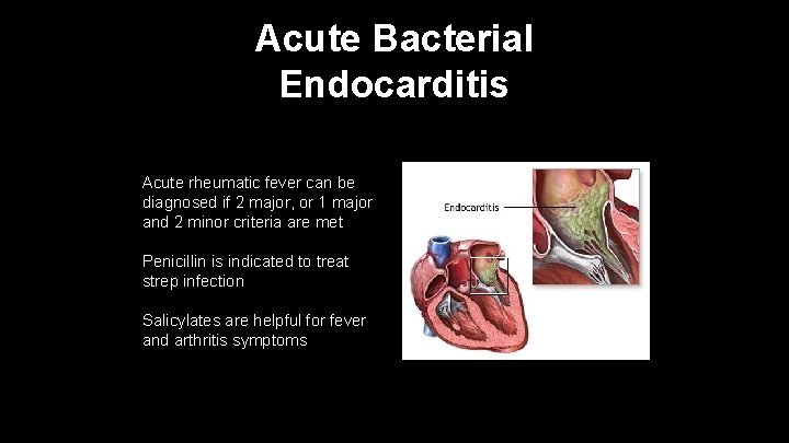 Acute Bacterial Endocarditis Acute rheumatic fever can be diagnosed if 2 major, or 1