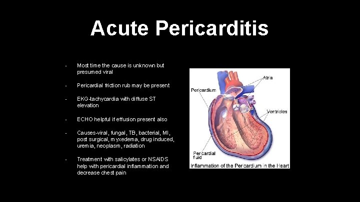 Acute Pericarditis • Most time the cause is unknown but presumed viral • Pericardial