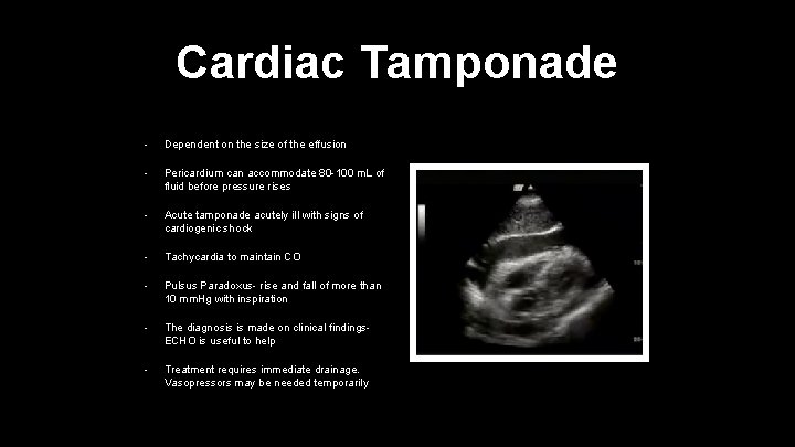 Cardiac Tamponade • Dependent on the size of the effusion • Pericardium can accommodate