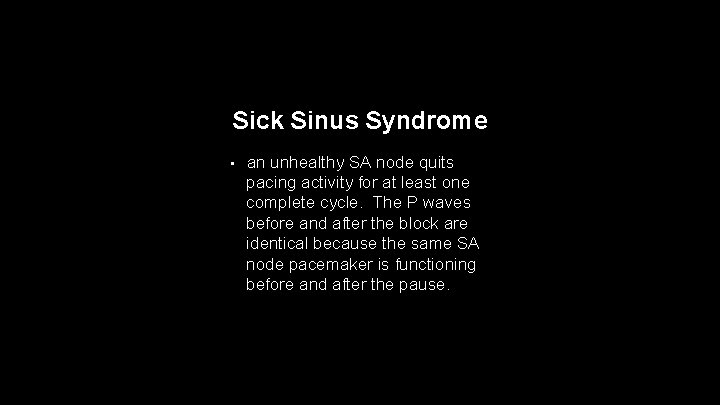 Sick Sinus Syndrome • an unhealthy SA node quits pacing activity for at least