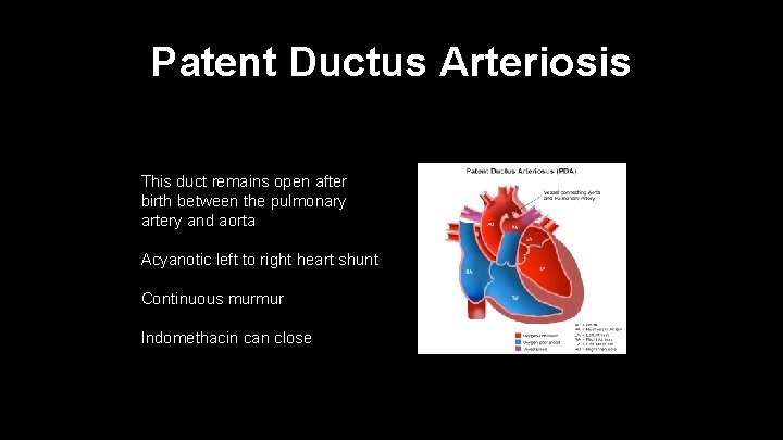 Patent Ductus Arteriosis This duct remains open after birth between the pulmonary artery and