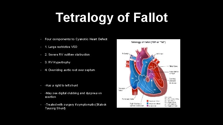 Tetralogy of Fallot • Four components to Cyanotic Heart Defect • 1. Large restrictive