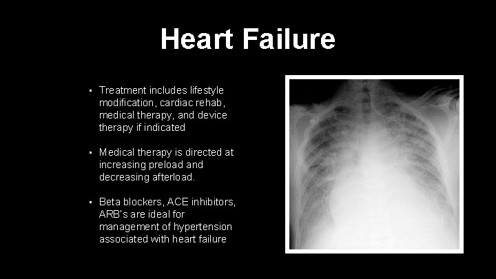 Heart Failure • Treatment includes lifestyle modification, cardiac rehab, medical therapy, and device therapy