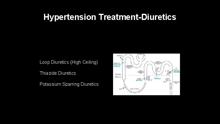 Hypertension Treatment-Diuretics Loop Diuretics (High Ceiling) Thiazide Diuretics Potassium Sparring Diuretics 