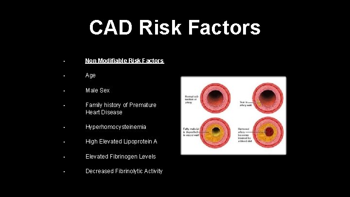 CAD Risk Factors • Non Modifiable Risk Factors • Age • Male Sex •