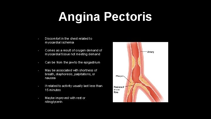 Angina Pectoris • Discomfort in the chest related to myocardial ischemia • Comes as