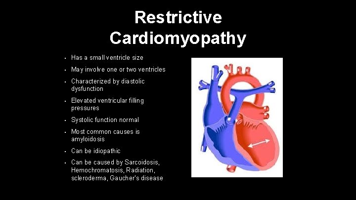 Restrictive Cardiomyopathy • Has a small ventricle size • May involve one or two