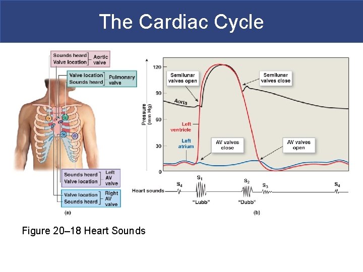 The Cardiac Cycle Figure 20– 18 Heart Sounds 