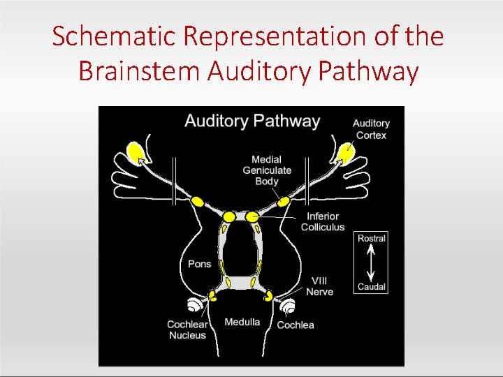 Schematic Representation of the Brainstem Auditory Pathway 