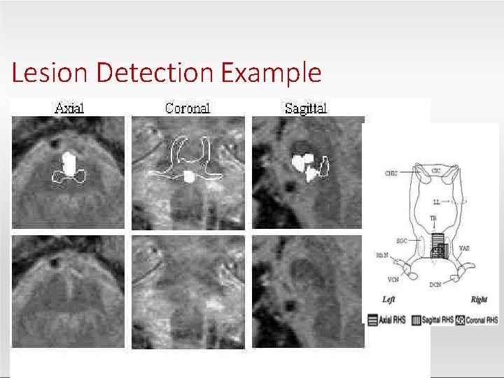 Lesion Detection Example 