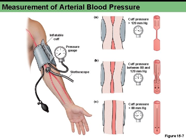 Measurement of Arterial Blood Pressure (a) Cuff pressure > 120 mm Hg Inflatable cuff