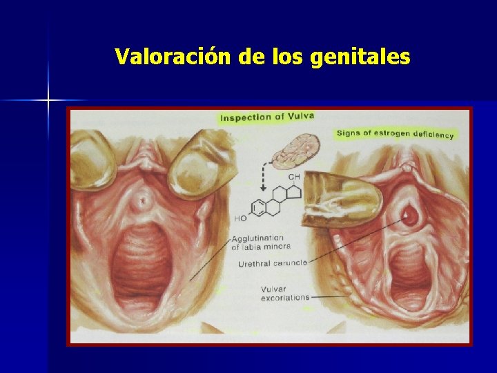 Valoración de los genitales 