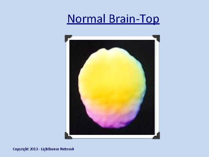 Normal Brain-Top Copyright 2013 - Lighthouse Network 