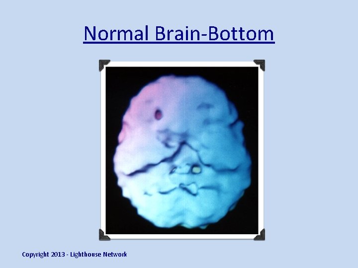 Normal Brain-Bottom Copyright 2013 - Lighthouse Network 