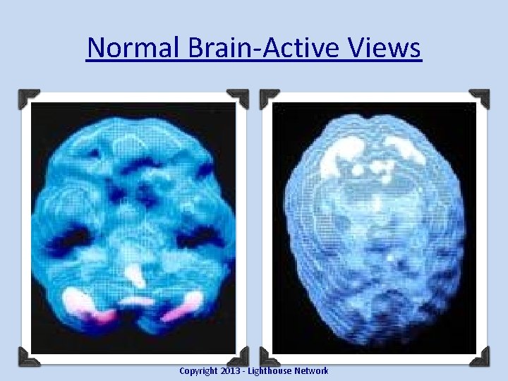Normal Brain-Active Views Copyright 2013 - Lighthouse Network 