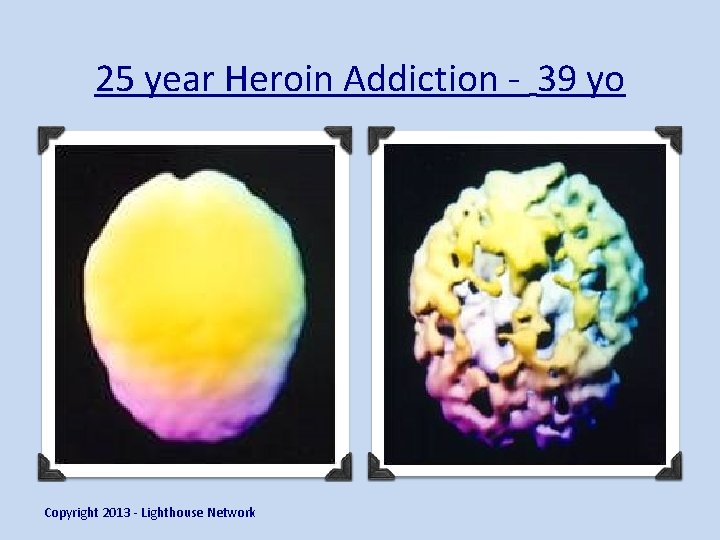 25 year Heroin Addiction - 39 yo Copyright 2013 - Lighthouse Network 
