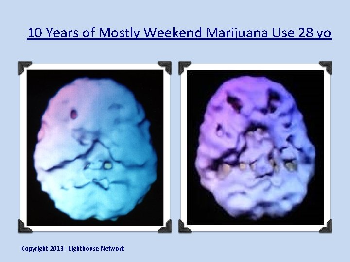 10 Years of Mostly Weekend Marijuana Use 28 yo Copyright 2013 - Lighthouse Network