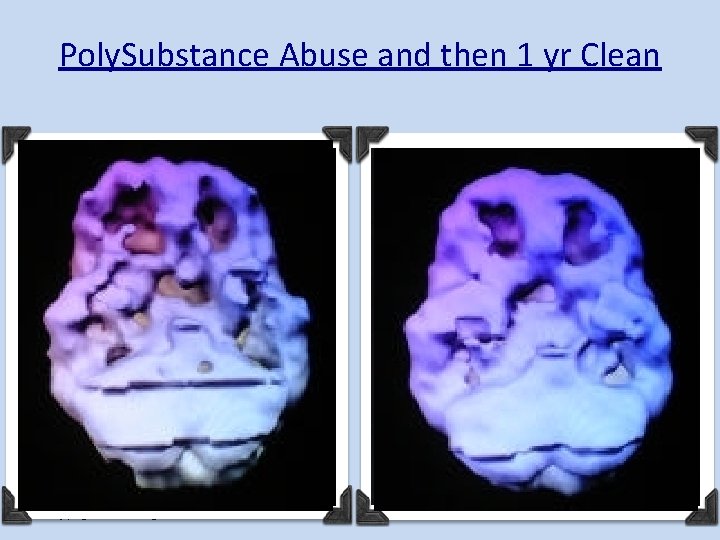 Poly. Substance Abuse and then 1 yr Clean Copyright 2011 - Lighthouse Network 