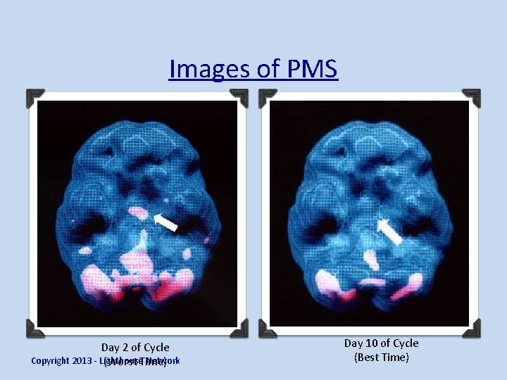 Images of PMS Day 2 of Cycle Copyright 2013 - Lighthouse Network (Worst Time)