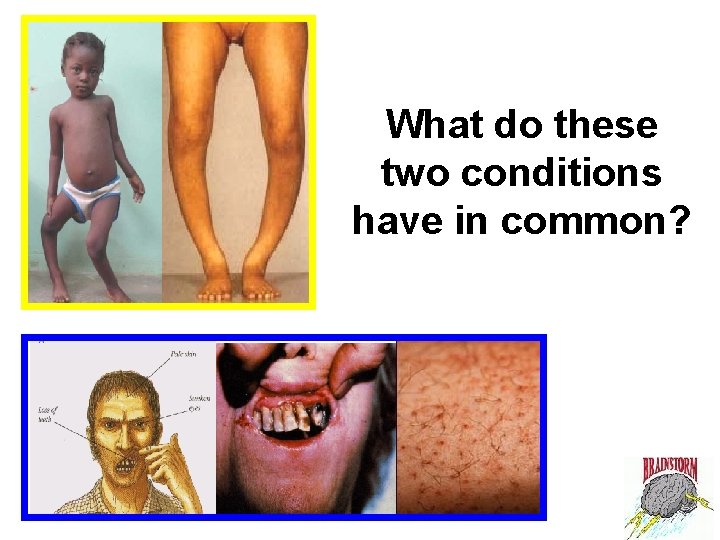 What do these two conditions have in common? 