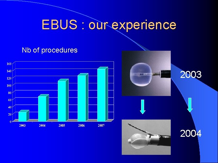 EBUS : our experience Nb of procedures 2003 2004 